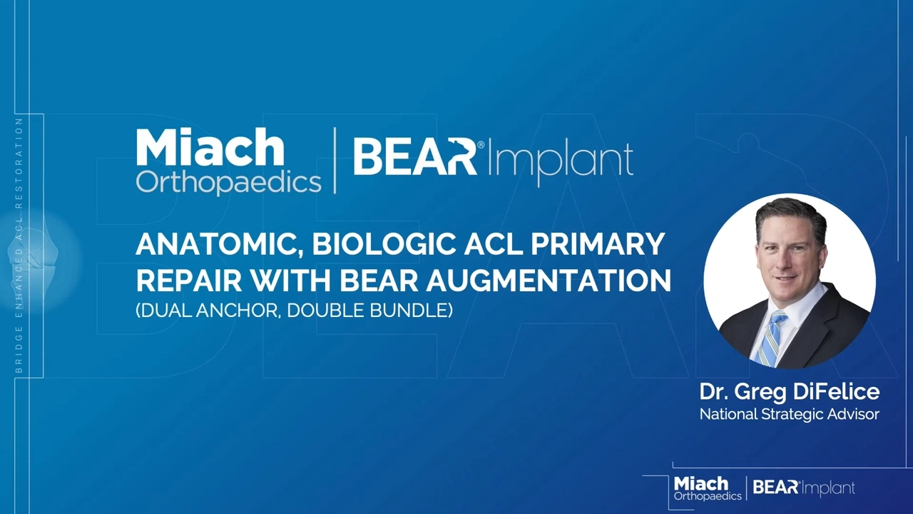 A title screen from the Dual Anchor Double Bundle BEAR Implant Surgical Technique video